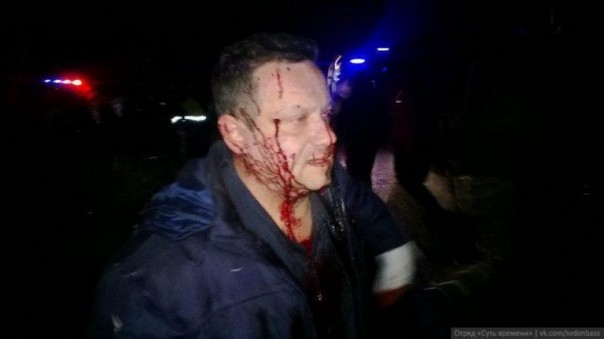 Укрофашисты открыли огонь из РСЗО «Ураган» и тяжелых орудий по Донецку, произведён обстрел «Точкой-У» Укрофашисты открыли огонь из РСЗО «Ураган» и тяжелых орудий по Донецку, произведён обстрел «Точкой-У»