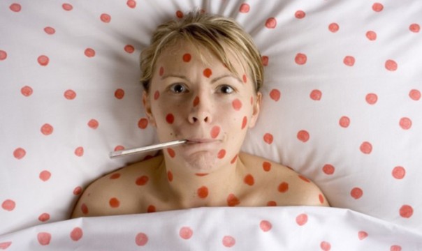 В Киеве ширится эпидемия кори — заболеваемость выросла в пять раз