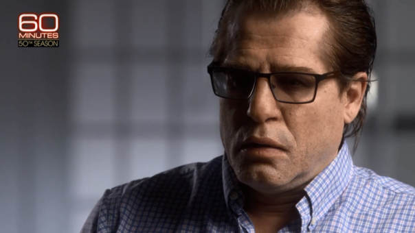 В США показали Родченкова после пластической операции