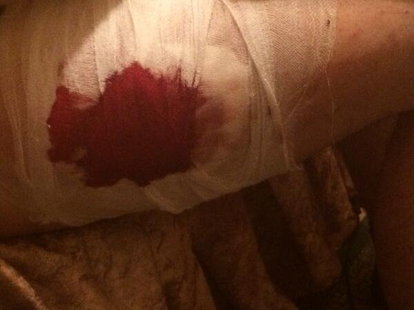 Иностранные журналисты попали под миномётный обстрел близ Славянска, предположительно 2 человека погибли Иностранные журналисты попали под миномётный обстрел близ Славянска, предположительно 2 человека погибли