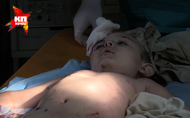 Под новым обстрелом в Славянске погибли трое мирных жителей, тяжело ранен пятилетний Арсений (видео 18+) Под новым обстрелом в Славянске погибли трое мирных жителей, тяжело ранен пятилетний Арсений (видео 18+)