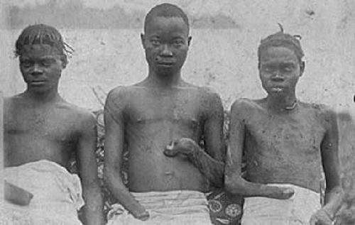 Отрубленные руки в качестве валюты Отрубленные руки в качестве валюты