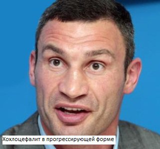 Украиноз — чума XXI века