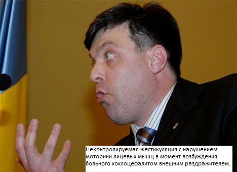 Украиноз — чума XXI века