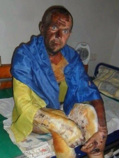 10 тысяч украинских силовиков уже прошли лечение у психиатра 10 тысяч украинских силовиков уже прошли лечение у психиатра