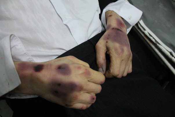 Сводки от ополчения Новороссии 17.11.2014 (Часть 2)