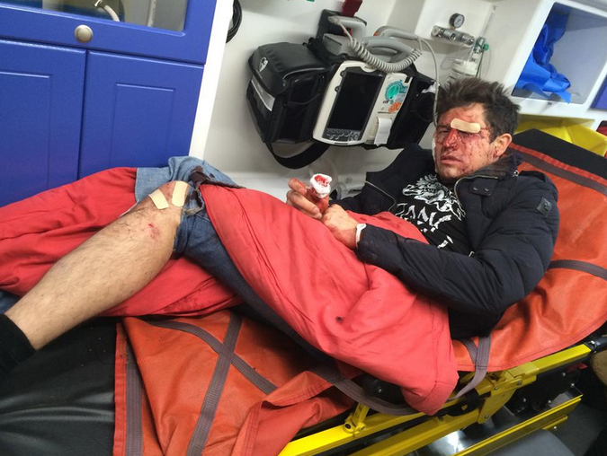 В Киеве избили шоумена и большого друга карателей  