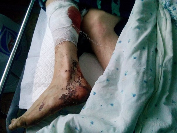 Сводки от ополчения Новоросси 09.12.2014 Сводки от ополчения Новоросси 09.12.2014