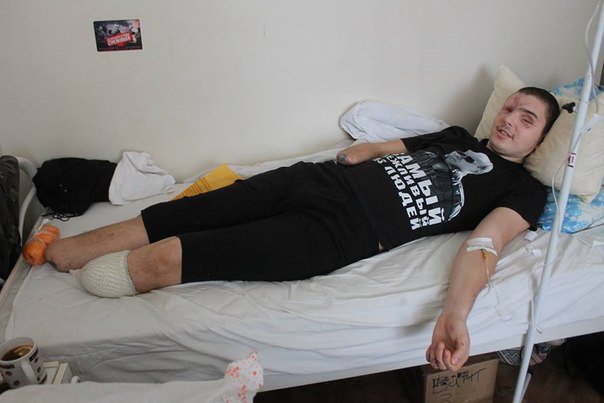 Грэм Филлипс совместно с "NewsFront" спасают парню жизнь. Боец "Востока" остался калекой. Грэм Филлипс совместно с "NewsFront" спасают парню жизнь. Боец "Востока" остался калекой.