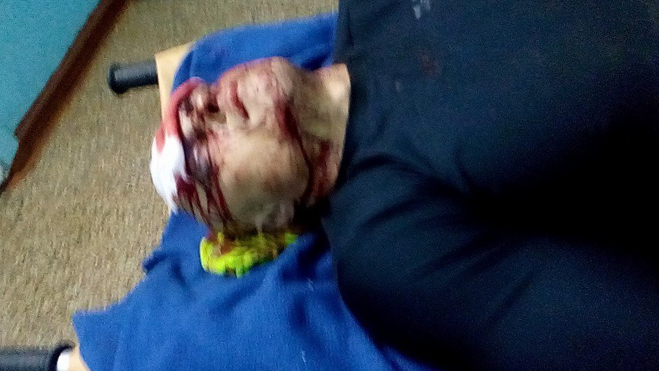 В Одессе евромайдановец самоизбил себя кондиционером В Одессе евромайдановец самоизбил себя кондиционером