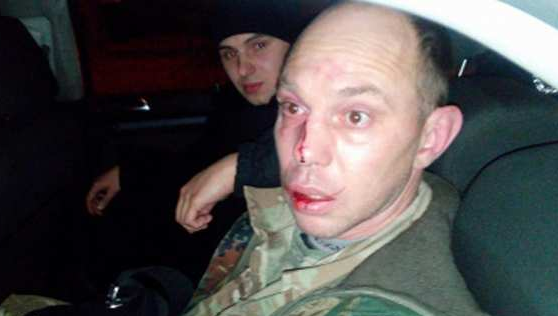 Гранату в Киеве взорвал «комбат» «ОУН», он был пьян и под наркотиками Гранату в Киеве взорвал «комбат» «ОУН», он был пьян и под наркотиками