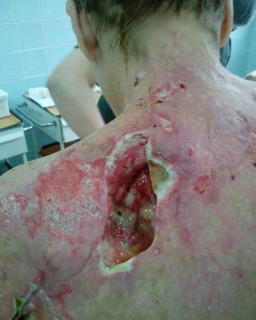 Хунта использует фосфорные снаряды против гражданского населения Хунта использует фосфорные снаряды против гражданского населения