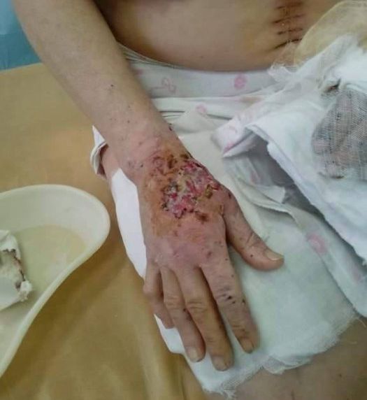 Хунта использует фосфорные снаряды против гражданского населения Хунта использует фосфорные снаряды против гражданского населения