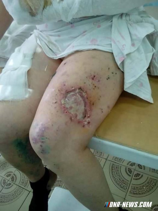 Сводки от ополчения Новороссии 02.02.2015 Сводки от ополчения Новороссии 02.02.2015