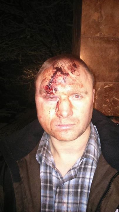 Вести из Цэевропы: в Закарпатье нацисты-правосеки жестоко отоварили... пособников нацистов Вести из Цэевропы: в Закарпатье нацисты-правосеки жестоко отоварили... пособников нацистов