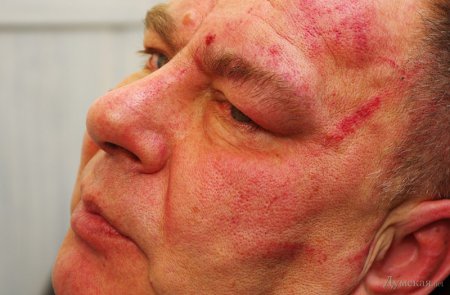 В Одессе активисты «евромайдана» устроили погром в офисе телеканала и избили журналистов