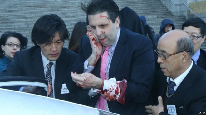 Мужчина с бритвой ранил посла США в Южной Корее Мужчина с бритвой ранил посла США в Южной Корее