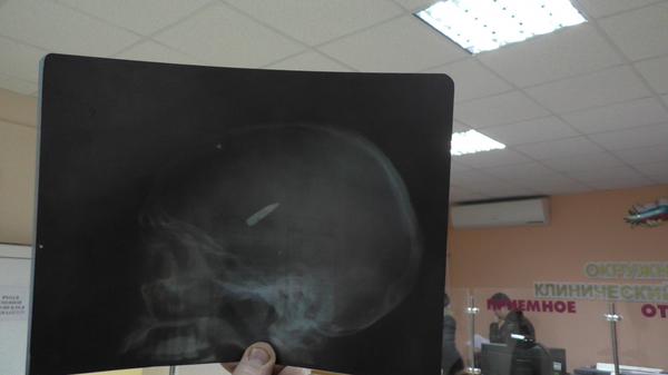 Сводки от ополчения Новороссии 05.03.2015