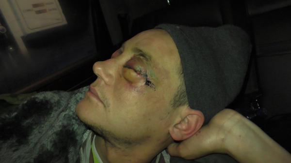 Сводки от ополчения Новороссии 05.03.2015