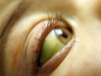 Из-за грязной воды Одессе грозит эпидемия гепатита - СЭС