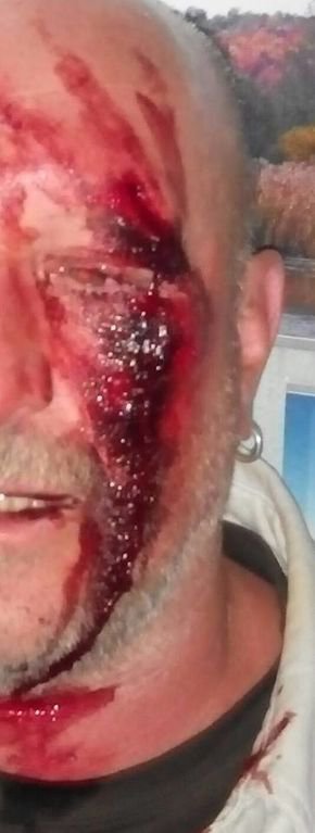 В Киеве на людей нападают и бьют уже в правительственном квартале