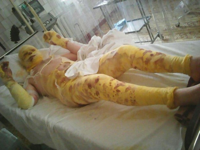 Как МО Украины убивает собственных солдат 