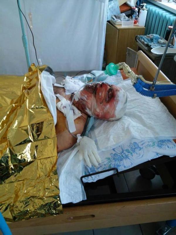 Сводки от ополчения Новороссии 11.08.2015 Сводки от ополчения Новороссии 11.08.2015