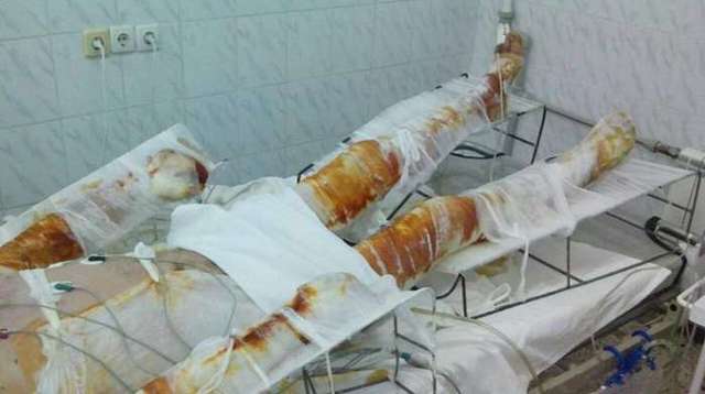 Украина убивает своих военных жадностью на закупку тканей Украина убивает своих военных жадностью на закупку тканей