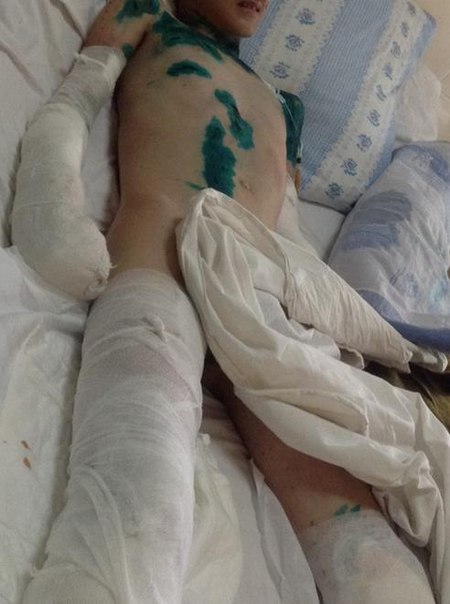 Сводки от ополчения Новороссии 12.08.2015