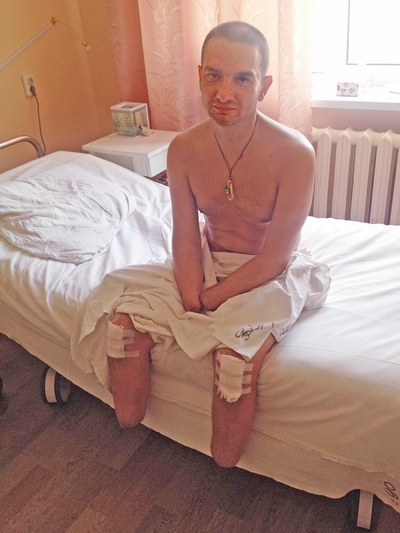 Сержант ВСУ, потерявший руки и ноги в Дебальцево, не получил инвалидности и не демобилизован Сержант ВСУ, потерявший руки и ноги в Дебальцево, не получил инвалидности и не демобилизован