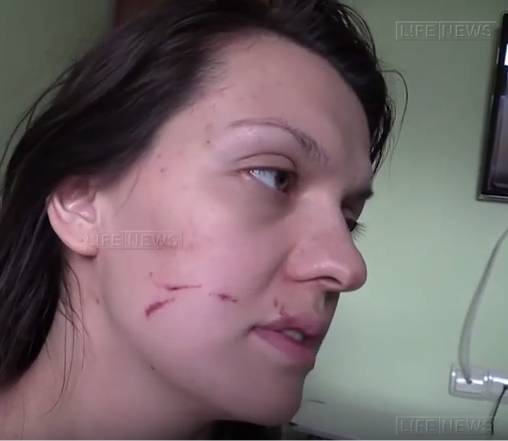 Врач элитной московской клиники избила беременную медсестру с Донбасса Врач элитной московской клиники избила беременную медсестру с Донбасса