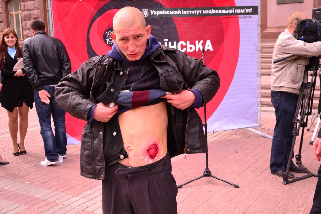 Киевская полиция задержала человека с вываливающимися кишками, пришедшего просить у Кличко деньги на операцию Киевская полиция задержала человека с вываливающимися кишками, пришедшего просить у Кличко деньги на операцию