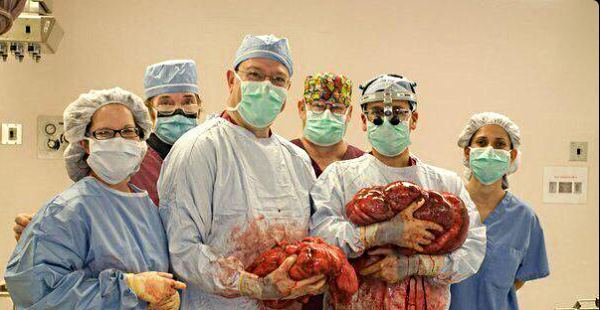 Э, а где же аппендикс? (истории)