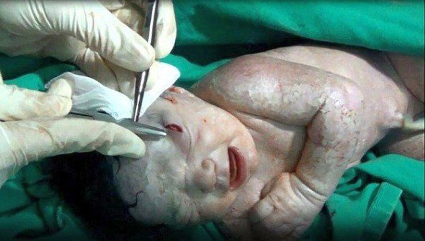 В Сирии малышка спасла свою мать В Сирии малышка спасла свою мать