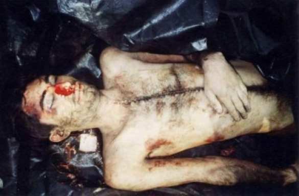 Саакашвили и торговля органами погибших и раненых в зоне «АТО» Саакашвили и торговля органами погибших и раненых в зоне «АТО»