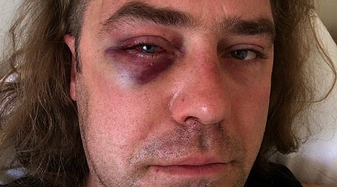 Близкий соратник Тягнибока зверски избит любовником бывшей жены Близкий соратник Тягнибока зверски избит любовником бывшей жены