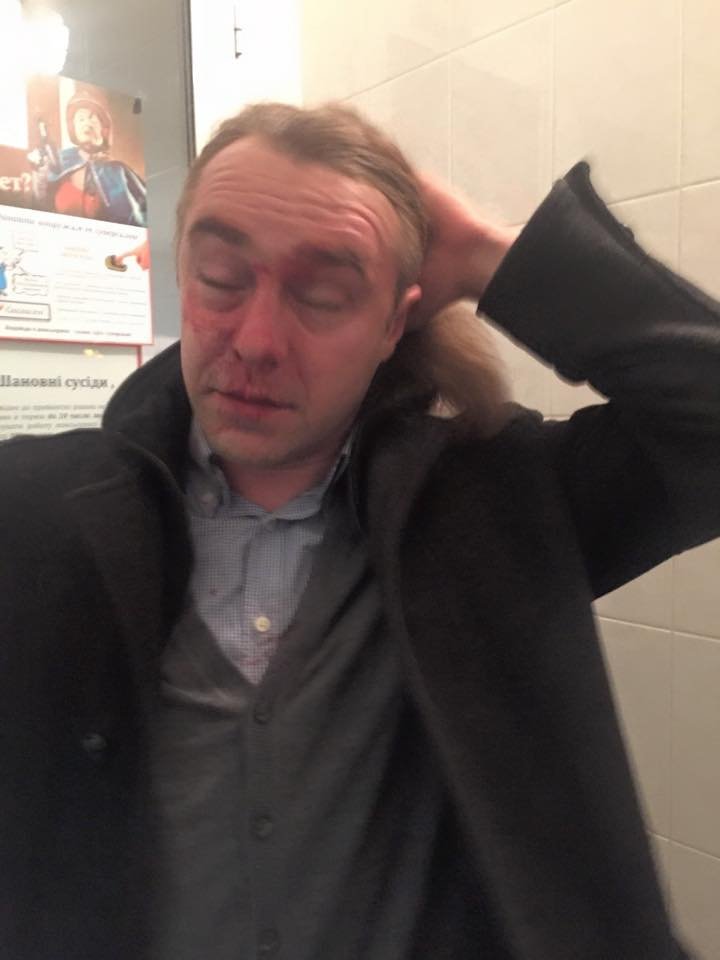 Близкий соратник Тягнибока зверски избит любовником бывшей жены Близкий соратник Тягнибока зверски избит любовником бывшей жены