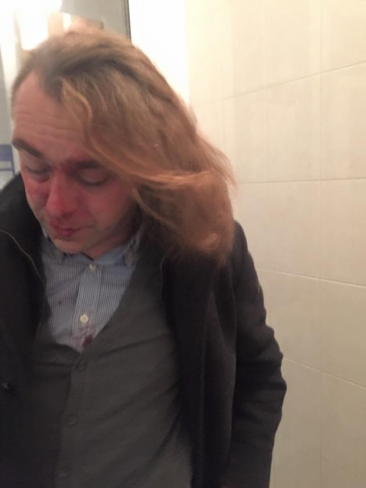 Близкий соратник Тягнибока зверски избит любовником бывшей жены Близкий соратник Тягнибока зверски избит любовником бывшей жены