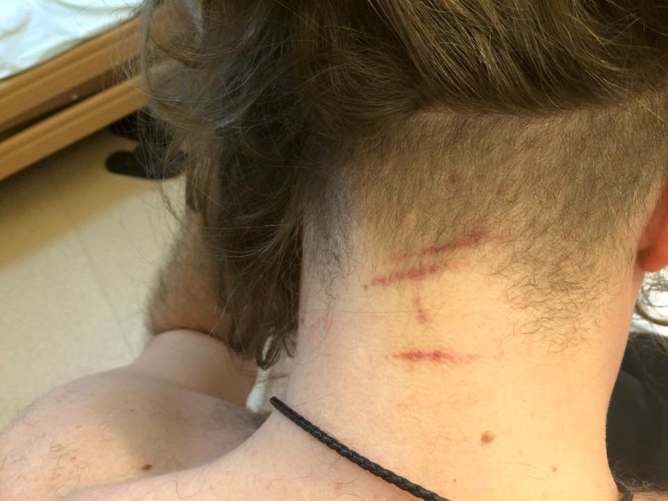 Близкий соратник Тягнибока зверски избит любовником бывшей жены Близкий соратник Тягнибока зверски избит любовником бывшей жены