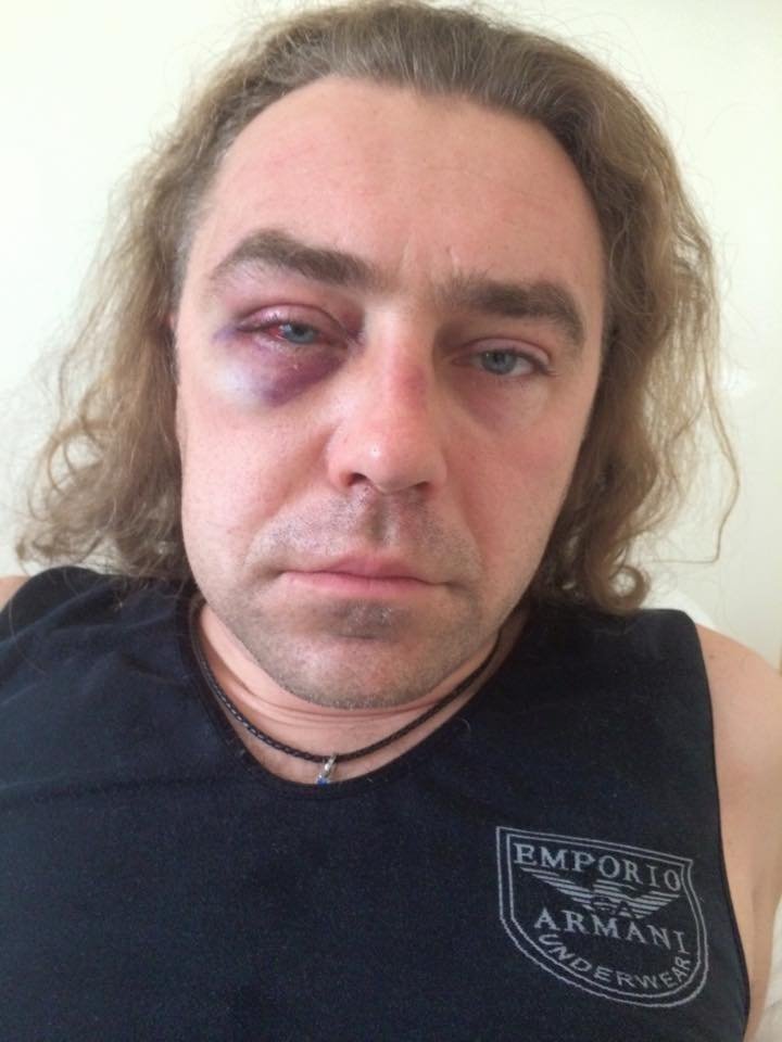 Близкий соратник Тягнибока зверски избит любовником бывшей жены Близкий соратник Тягнибока зверски избит любовником бывшей жены