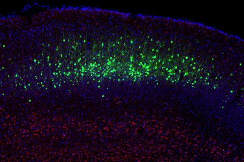 Ученые разработали технологию перепрограммирования нейронов мозга и реконфигурации нейронных сетей Ученые разработали технологию перепрограммирования нейронов мозга и реконфигурации нейронных сетей