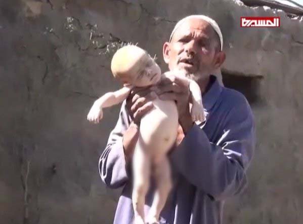 Война в Йемене. Декабрь 2015 Война в Йемене. Декабрь 2015