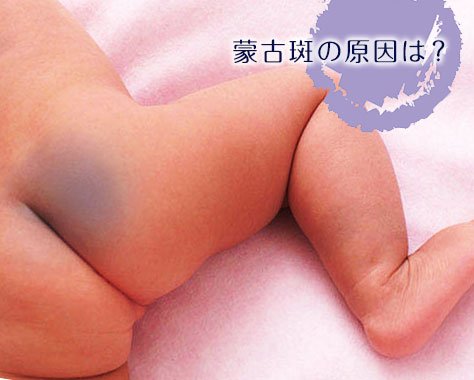 Украина: как японка рожала в Украине Украина: как японка рожала в Украине