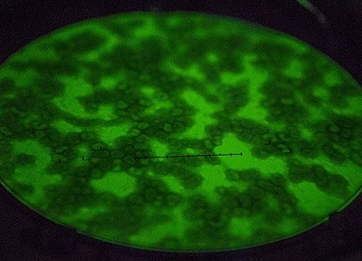 ТАСС. Специальный проект: Заразен и очень опасен