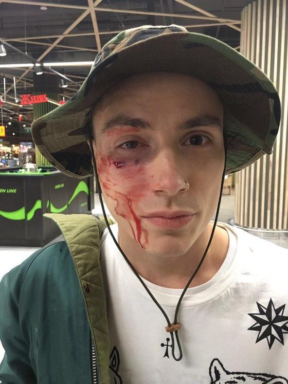 Неизвестные избили солиста группы Quest Pistols Show в центре Киева Неизвестные избили солиста группы Quest Pistols Show в центре Киева