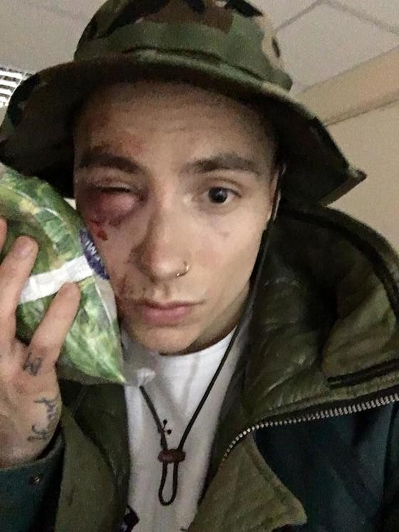 Неизвестные избили солиста группы Quest Pistols Show в центре Киева Неизвестные избили солиста группы Quest Pistols Show в центре Киева