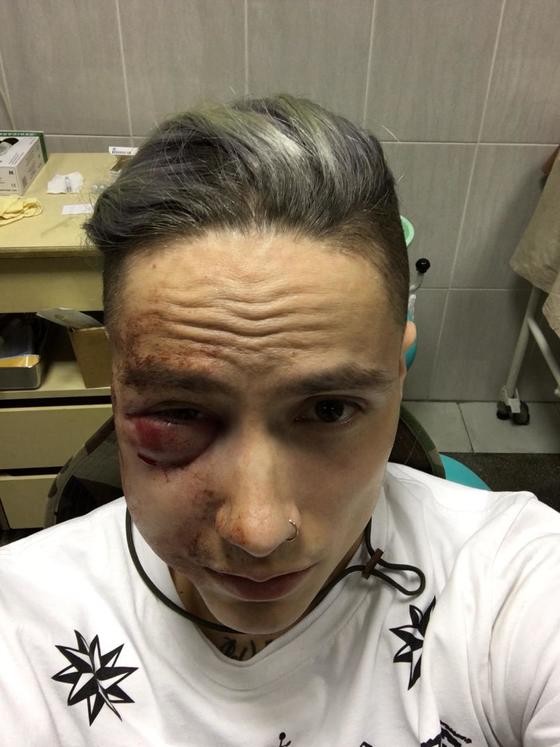 Неизвестные избили солиста группы Quest Pistols Show в центре Киева Неизвестные избили солиста группы Quest Pistols Show в центре Киева