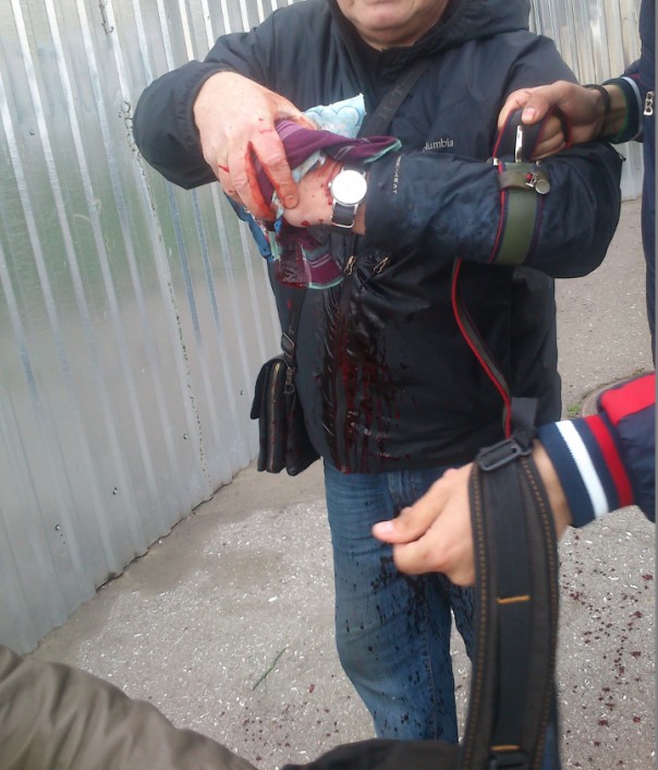 Взрыв на Куликовом поле в полиции сочли хулиганством Взрыв на Куликовом поле в полиции сочли хулиганством