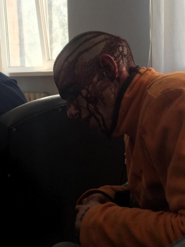 Это Европа: В центре Киева — кровавые разборки за гостиницу, есть погибший Это Европа: В центре Киева — кровавые разборки за гостиницу, есть погибший