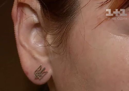 Вдову киборга избили в Днепре за украинский язык Вдову киборга избили в Днепре за украинский язык